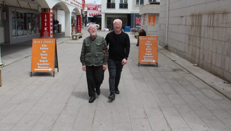 Ailesinin geçimi, babası ve kardeşi gibi kendisi de albino olan Gökhan’a emanet