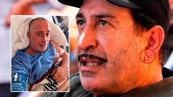 Cem Yılmaz’ın kulağındaki kalp krizi detayı! Doktor çizgiyi gösterdi: ‘Yıllardır var’