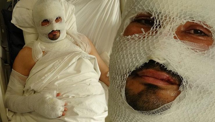 Hatay’da dehşet! Mumyaya döndü: Başımızın üstündeki lamba ve yerdeki telefon patladı