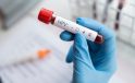 HPV tehlikesi ne kadar yaygın?