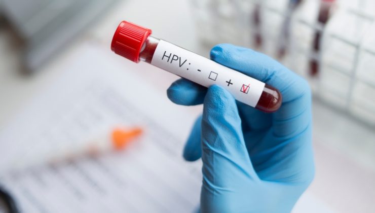 HPV tehlikesi ne kadar yaygın?