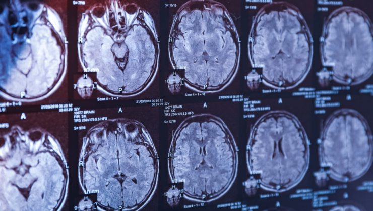 Mucize peptit çağı başlıyor: FDA’dan oreksine yeşil ışık