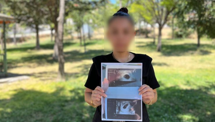 Sağlıklı bebeğe ölü raporu verdiler!