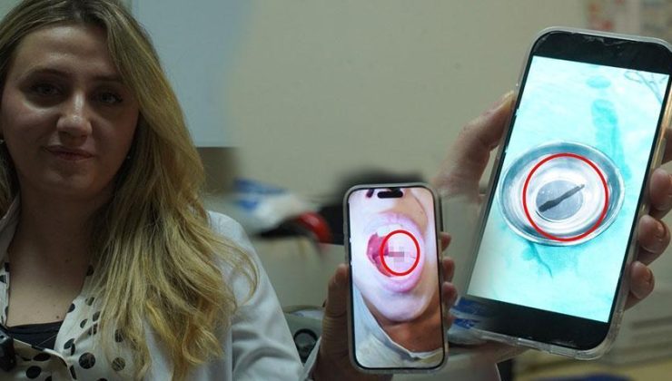 Doktor muayenede fark etti! 10 yaşındaki çocuğun boğazından canlı sülük çıktı