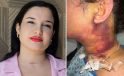 Estetik operasyonu kâbusla son buldu!