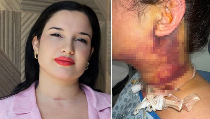 Estetik operasyonu kâbusla son buldu!