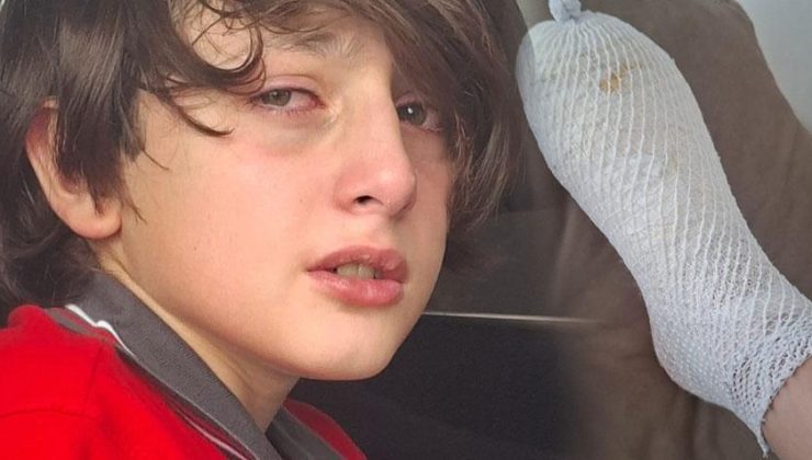 Ödül olarak alınan oyuncak elinde patladı! 11 yaşındaki Furkan 2’nci derece yandı
