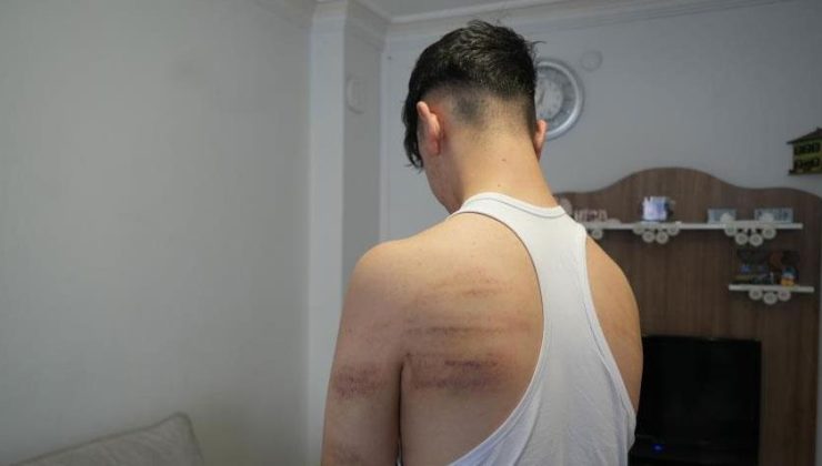 15 yaşındaki çırak dehşeti yaşadı! Demir sopa ile dövüldü: Süpürge sapını üzerimizde kırdı