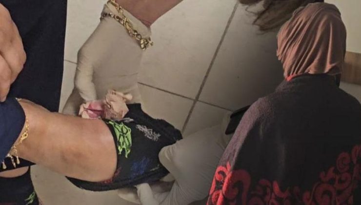 Dilencinin akılalmaz para saklama taktiği! Ekipler şaşkına döndü