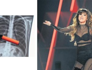 ‘E-sigara sesimi değiştirdi’