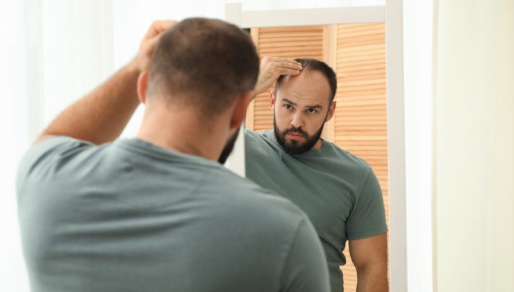 Kelliğe karşı hap geliştirildi! 6 ay boyunca saç çıkardı