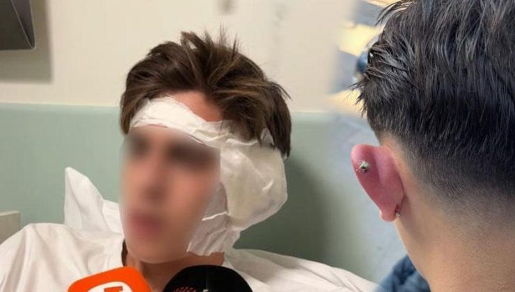 Piercing sonrası hastanelik olmuştu! Korkunç olay sonrası yeni gelişme