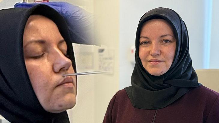 Yıllarca alerji sandığı burun akıntısının nedenini öğrenince şoka girdi